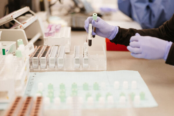 A nurse prepares blood samples to check for lipid disorders
