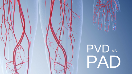 A visual comparison of peripheral vascular disease (pvd) versus peripheral artery disease (pad), highlighting the blood vessels in the lower limbs to illustrate heart health and circulatory concerns.