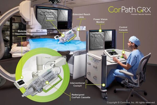 A diagram showing the components of The Corindus CorPath® GRX System in use with a doctor controlling the mechanism and a patient on a bed
