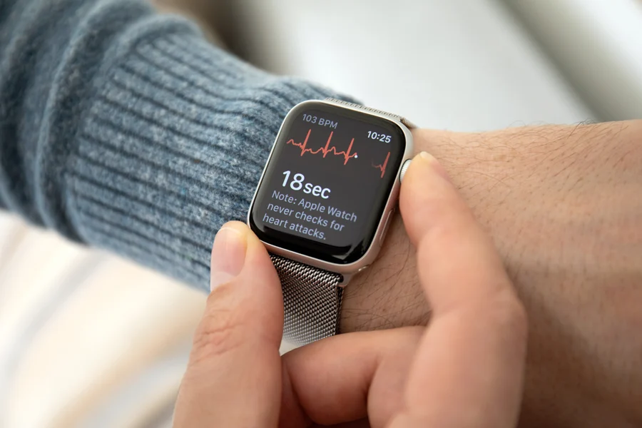 Smartwatch on a wrist displaying an ECG reading and a notification from a Cardiologist about heart health.