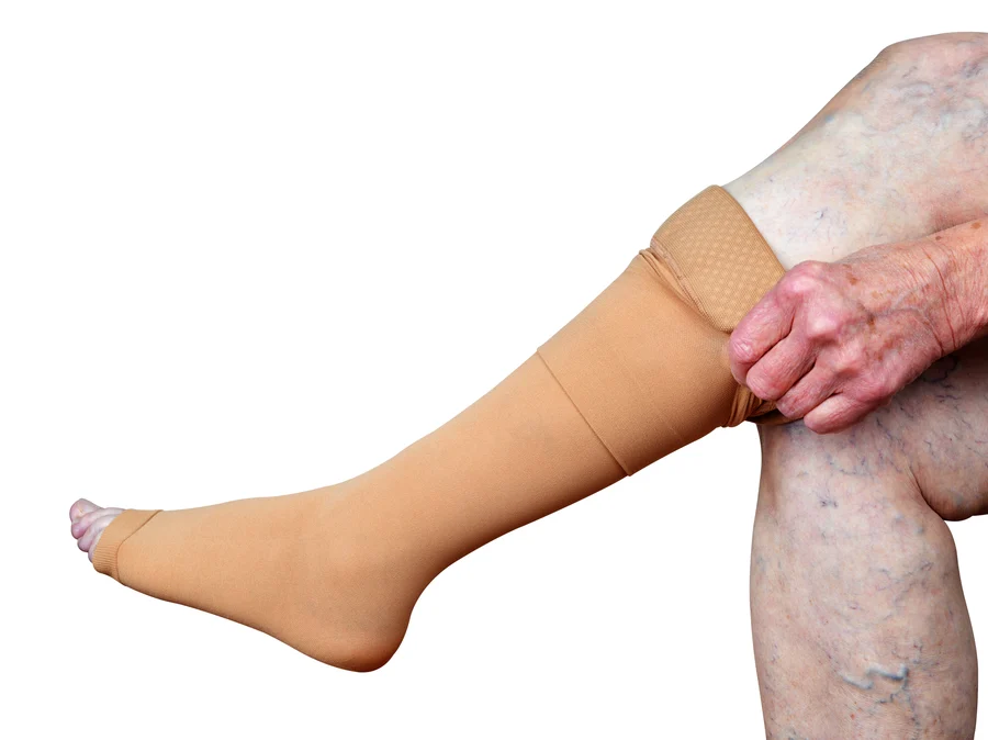 An elderly person wearing a compression stocking on their leg to help with circulation as recommended by their cardiologist.