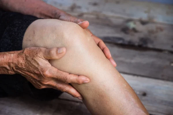 Gentle hands providing care: a close-up of a person's hands holding onto a knee, showcasing a moment of support and possibly pain relief related to Venous Disease.