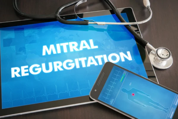 Medical diagnosis and technology concept: a digital tablet displaying the words "mitral regurgitation" with an ecg waveform in the background, accompanied by a stethoscope and a smartphone on