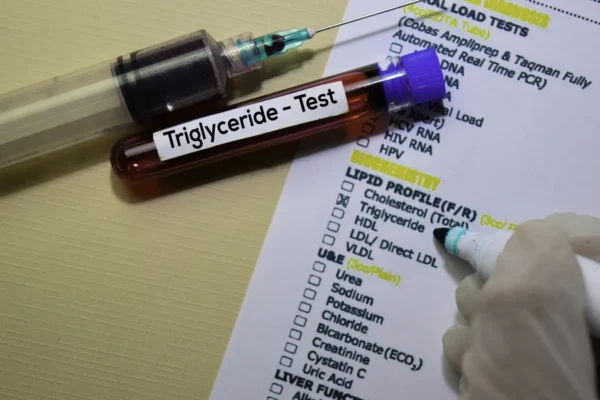 A blood sample tube and syringe rest on a lipid profile test form from the Cardiovascular Institute of the South, with "triglyceride - test" highlighted, indicating a focus on measuring trig