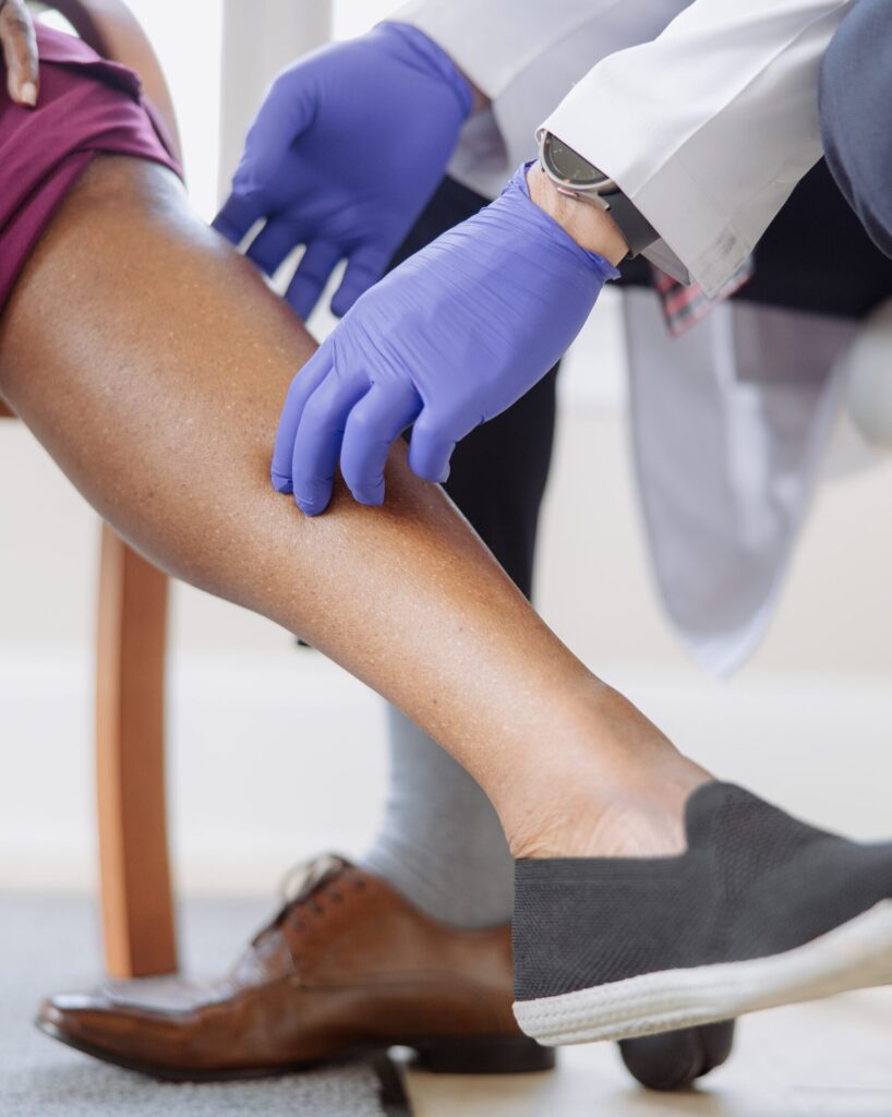 A healthcare professional wearing gloves examining a patient's lower leg.
