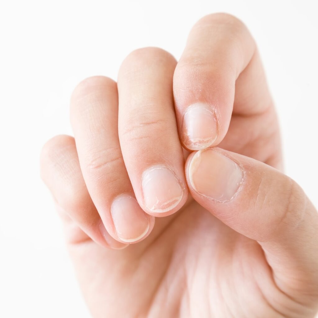 Close up of a person's hand and fingernails